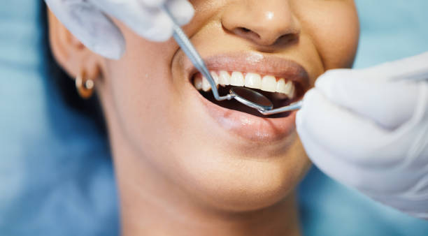 Best Emergency Dental Care for Broken or Chipped Teeth in Avenel, NJ